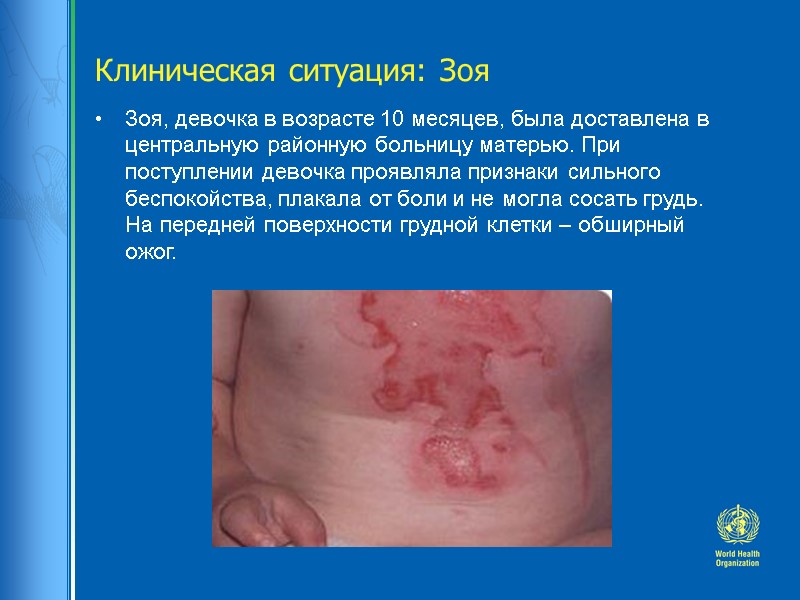 Клиническая ситуация: Зоя  Зоя, девочка в возрасте 10 месяцев, была доставлена в центральную